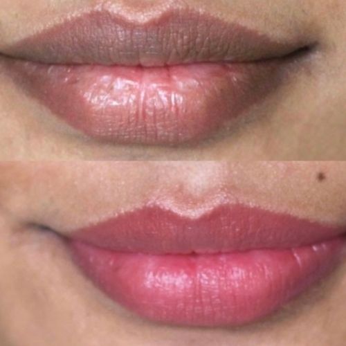 Cosmetic lip tattoo